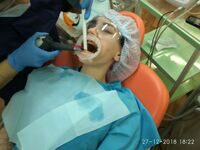 Гигиена полости рта